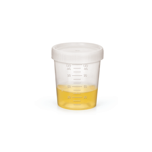 120㎖ PP Specimen Container, with HDPE Screw Cap, Graduation, Marking Area, Φ63×h70mm Ideal for Urine, Medical Sample, etc., Sterile & Non-sterile, 샘플 컨테이너, 소변 및 의료용 샘플 검사용, 멸균 & 비멸균